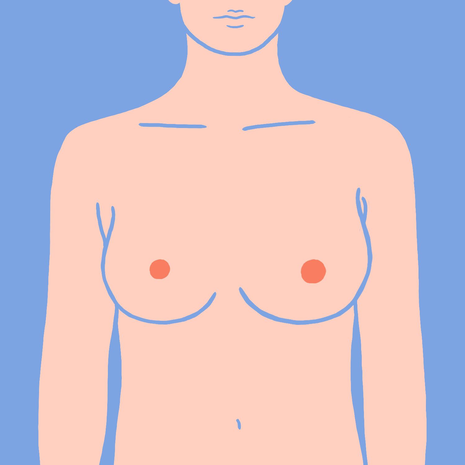 kuinka löytää paras rintaliivit rintojen muodolle epäsymmetrinen