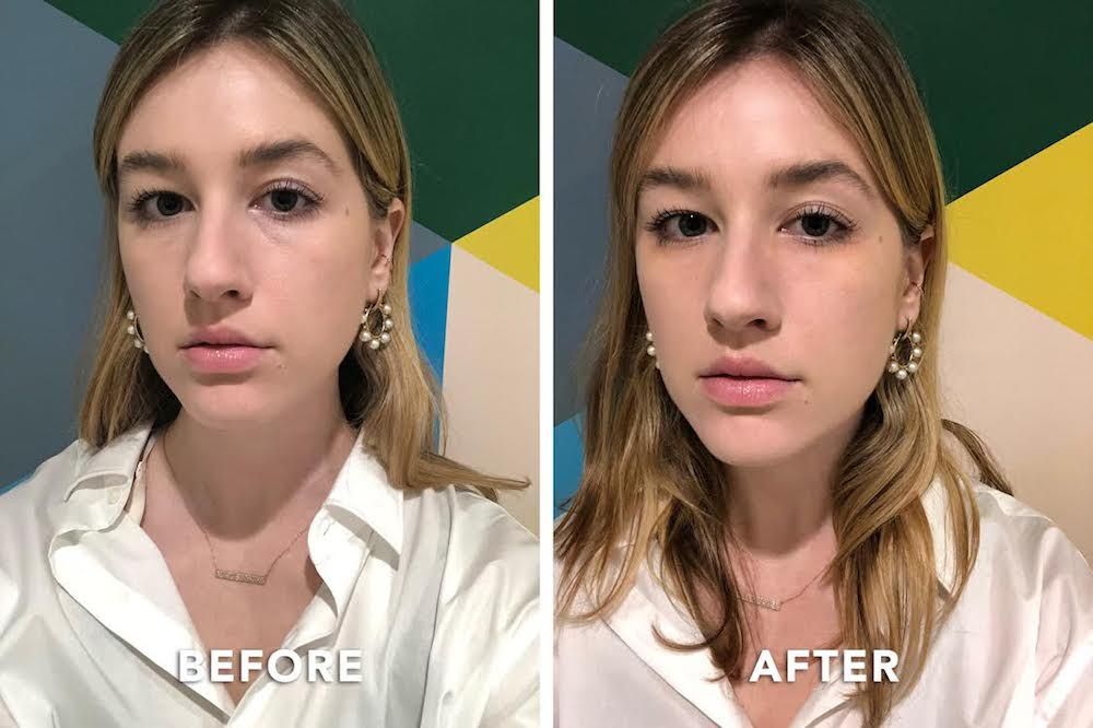Las mejores fotos de antes y después de la crema para los ojos